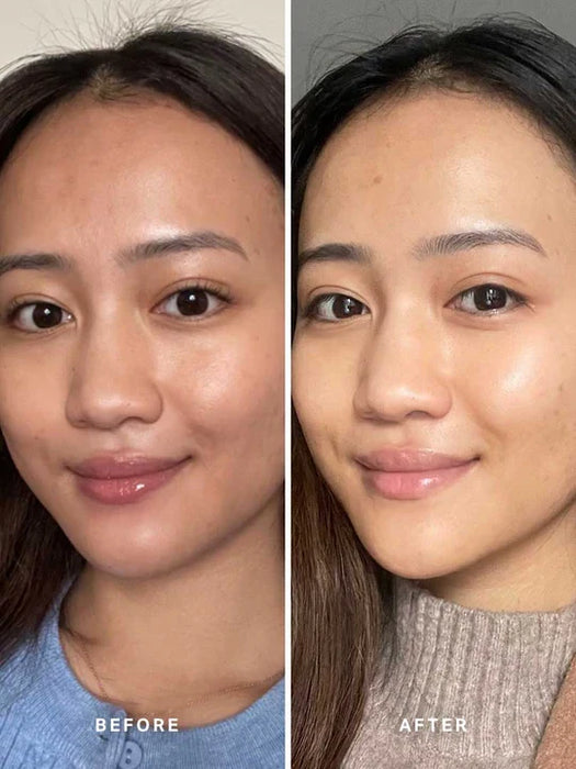 Alpha-H Liquid Gold 100ml